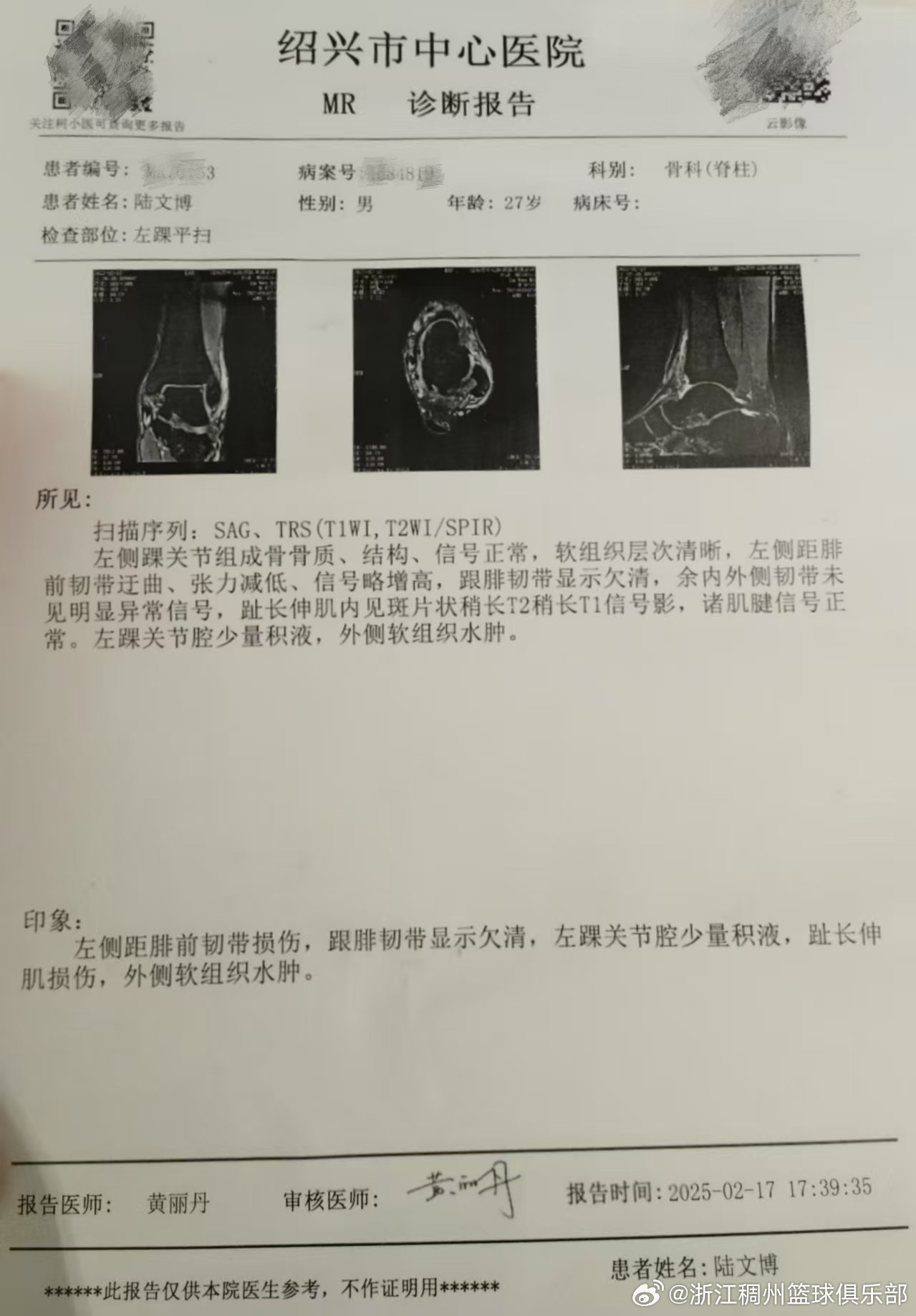 并加强团队